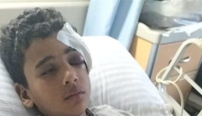 إصابة صغير بكسر في الجمجمة وتهتك بالفك إثر رشقه بالحجارة خلال ركوبه قطارًا بالمنوفية | بث مباشر