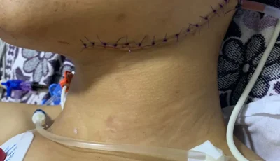 نجاة شاب من الموت بإجراءات طبية عاجلة في جراحة الأوعية بالفيوم