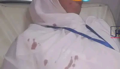 الاعتداء على ممرضة بمستشفى بسوهاج بعد رفضها دخول 15 مرافقا مع إحدى الحالات داخل غرفة الطوارئ