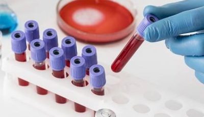 وخزة إصبع تكشف الزهايمر قبل ظهور الأعراض