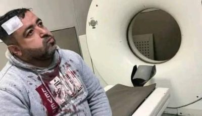 ملثمان يعتديان على صحفي أردني أمام أسرته